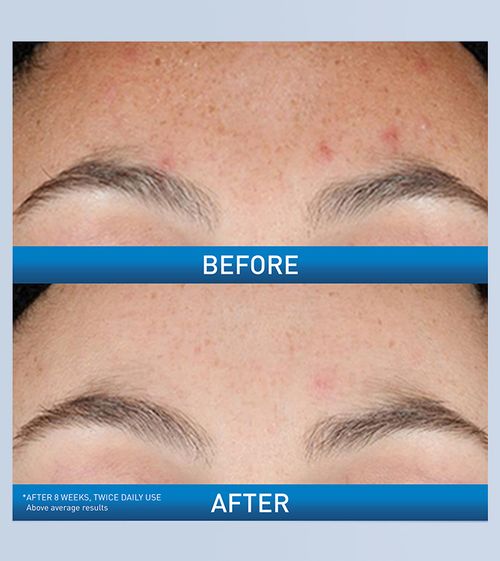 Resurfacing Retinol Serum | Smoothing, anti-aging, and renewal.